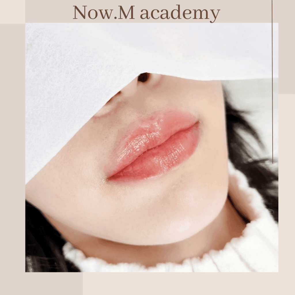 나우엠 입술 시술 전후 사진 7